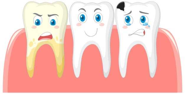 3. Имплантация зубов