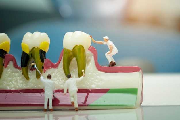 undefinedОсновной причиной кариеса</strong> является накопление бактерий на поверхности зубов и в области десен. Бактерии питаются остатками пищи, особенно сахаром, и выделяют кислоту, которая разрушает эмаль зубов. Если кариес не лечится вовремя, он может проникнуть в глубокие слои зуба и вызвать инфекцию, повреждение нервов и потерю зуба.