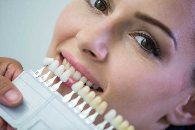 Какие методы отбеливания зубов существуют